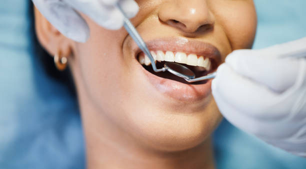Best Emergency Dental Care for Broken or Chipped Teeth in Fox Lake, WI